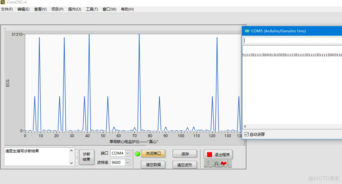 android 蓝牙socket心电图 蓝牙式心电监护_串口_07